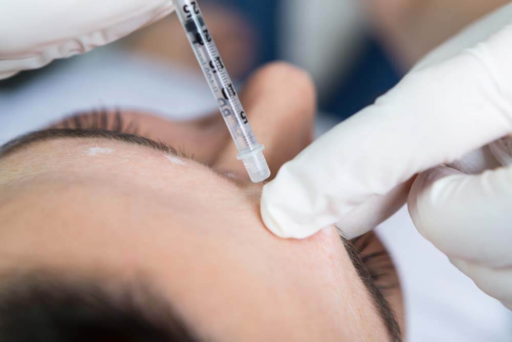 Fjerning av sinnarynke hos klinikk Haukeland