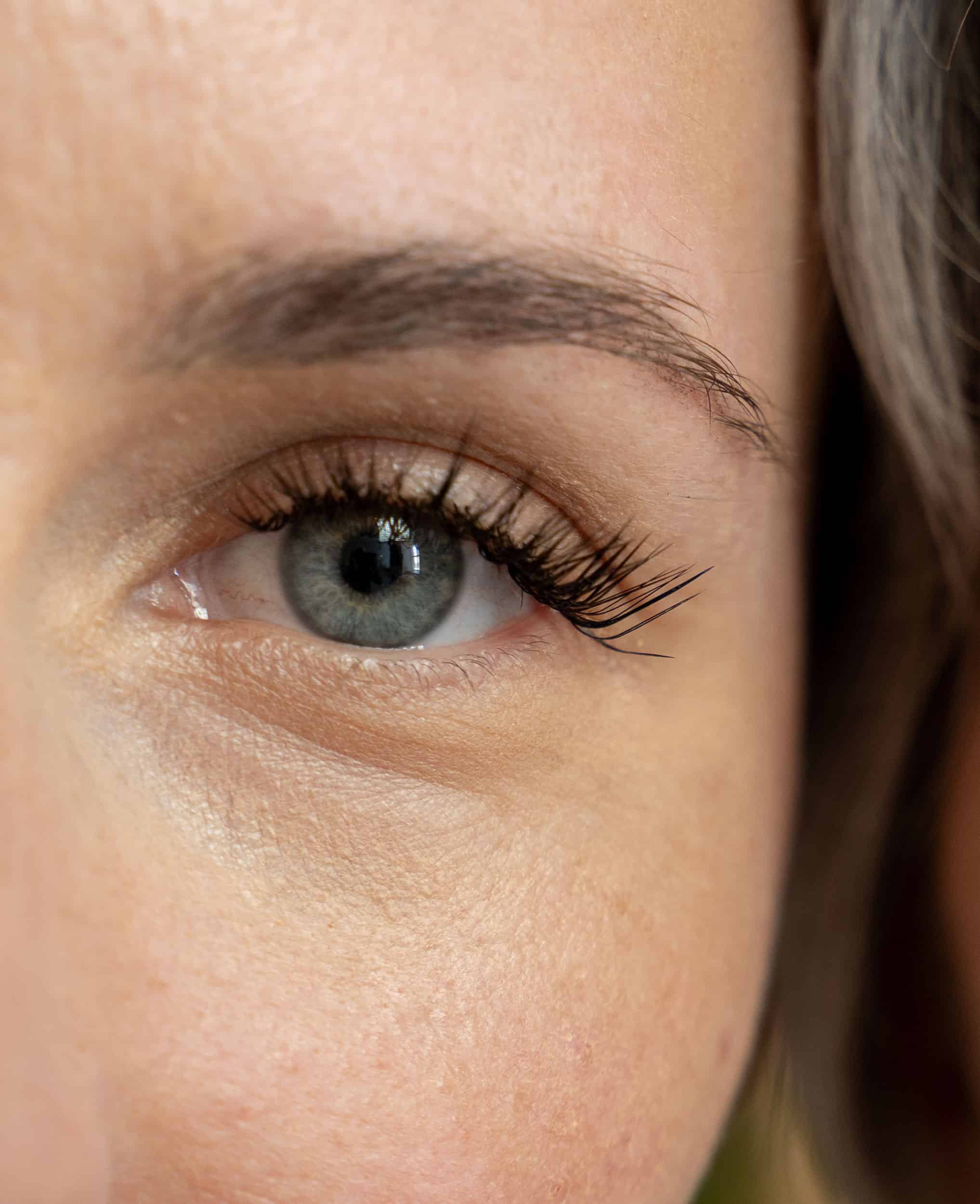 Nærbilde av ett øye og et kinn som viser hvordan huden har blitt etter en skinvive behandling hos Klinikk haukeland i drammen